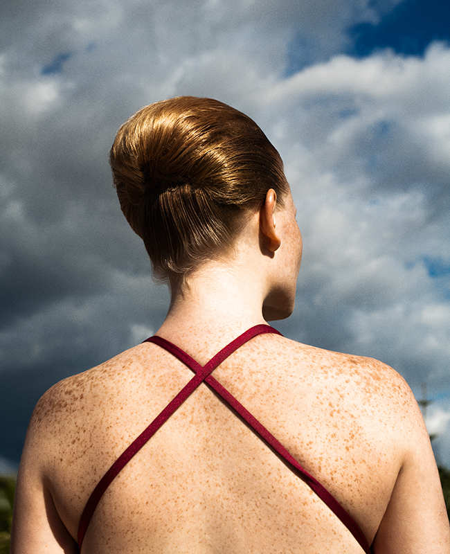 Sommersprossige Rückenansicht einer Frau mit gekreuzten Badeanzug-Trägern noch ohne After Sun-Pflege.