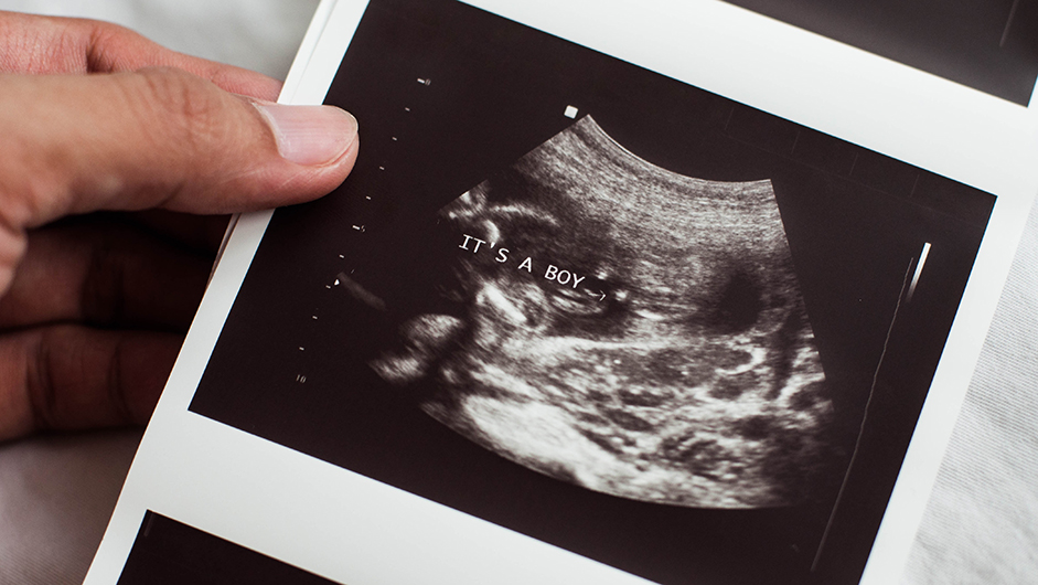 Hand hält Ultraschallbild von einem Jungen mit dem Schriftzug "It's a Boy"